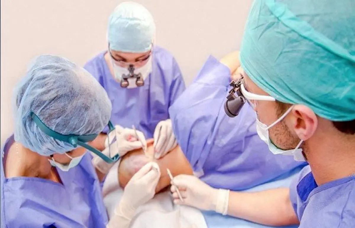 کاشت مو از بدن چگونه انجام می شود ؟

