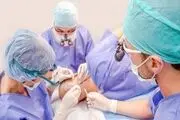 کاشت مو از بدن چگونه انجام می شود ؟
