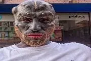 عمل جراحی عجیب از جوان 32 ساله موجودی شبیه هیولای فضایی ساخت +عکس