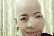  بی‌توجهی خانم تایلندی به دندان درد+ عکس