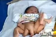 تولد نوزاد ۶پا + عکس
