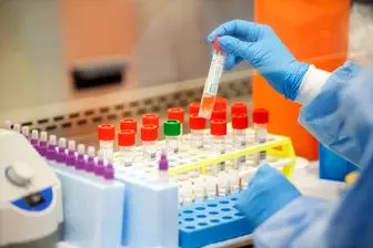 فهرست جدید آزمایشگاه های تشخیص کرونا اعلام شد
