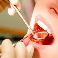 برای پیشگیری از پوسیدگی دندان چه باید کرد؟