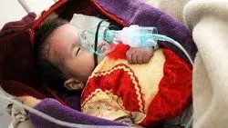 تعداد قربانیان بیماری وبا در یمن از ۲۳۰۰ تن گذشت