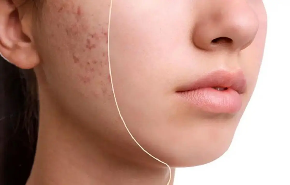 جوشها به ما چه میگویند؟