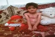 بیماری بی صدای که کودک رودباری را همچون پروانه پر پر می کند