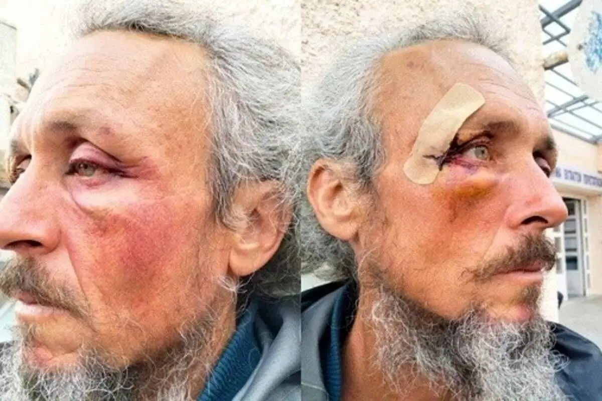 جزئیات شکنجه ۴۰ ساعته فعالان کاروان صمود