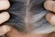 لوتئولین؛ راهی طبیعی برای جلوگیری از خاکستری شدن موها؟