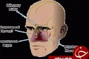 اعضای بی استفاده در بدن انسان + عکس