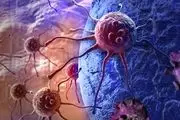 نابودی تومورهای سرطانی با کمک نانو حباب‌ها
