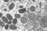 آخرین آمار سازمان جهانی بهداشت درمورد آبله میمون