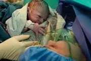 سزارینی‌ها می توانند زایمان طبیعی داشته باشند؟