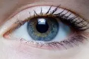 راهکار مقابله با سوزش چشم هنگام آلودگی هوا