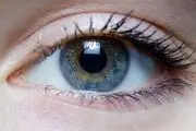 پف زیر چشم را چگونه از بین ببریم؟