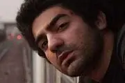 سوختگی شدید بازیگر جوان /عکس