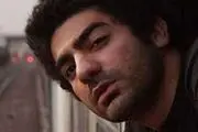 سوختگی شدید بازیگر جوان /عکس