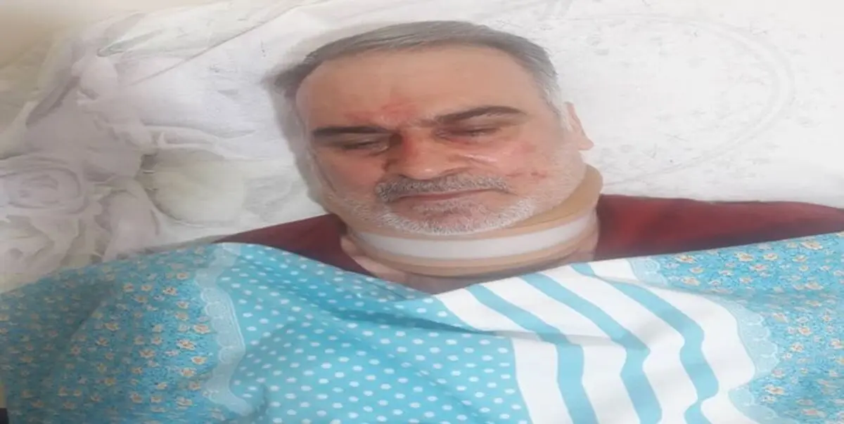 مصدومیت جانباز دفاع مقدس هنگام امر به معروف و نهی از منکر+عکس

