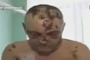 ماده مخدر گوشتخوار موسوم به 