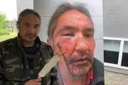 واکنش‌ها به حمله پلیس کانادا به یک بومی