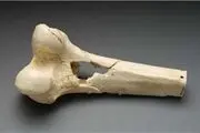 راه‌های محافظت از استخوان کودکان