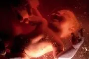 دلایل عمدی سقط جنین در کشور