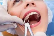 معرفی رایج ترین خدمات عمومی دندانپزشکی