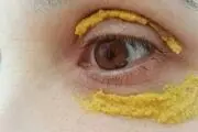 معجون معجزه آسا برای برطرف کردن گودی چشم