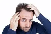 نقش شامپوها در بهبود ریزش موی غیرطبیعی چیست؟