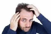 اگر ریزش مو دارید بخوانید