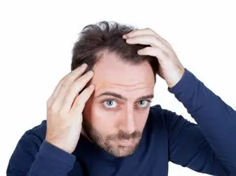 نقش شامپوها در بهبود ریزش موی غیرطبیعی چیست؟