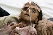 کابوس قحطی و گرسنگی برای کودکان یمنی