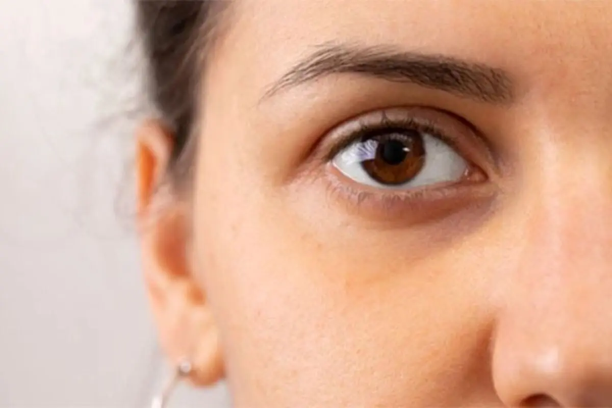 برای رفع گودی چشم چه کارهایی انجام دهیم


