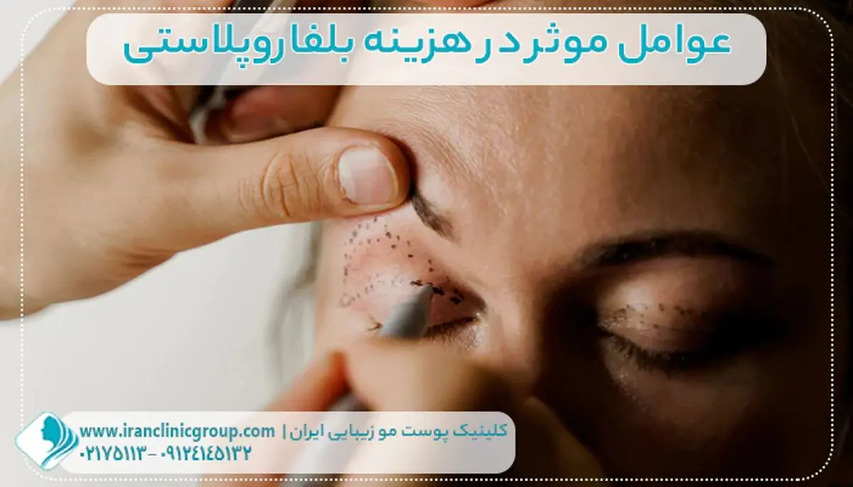 علت کوچک شدن چشم بعد از عمل بلفاروپلاستی