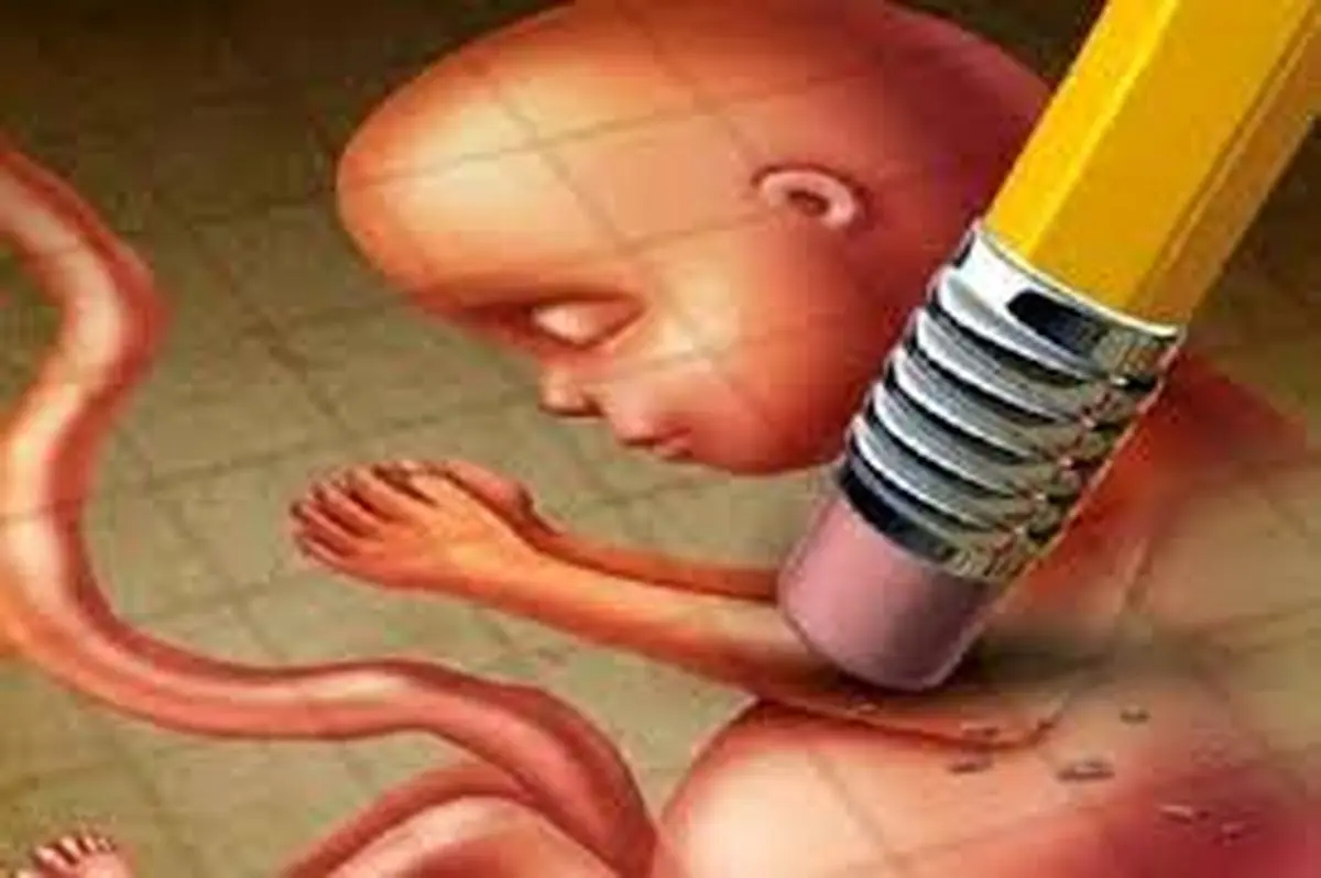 صدور مجوز سقط درمانی کاهش یافت
