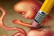 صدور مجوز سقط درمانی کاهش یافت