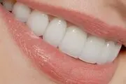 به لثه هایتان بیشتر توجه کنید