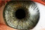 ناخنک یکی از شایع‌ترین بیماری‌های چشم