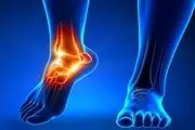 درد‌های مچ پا چه زمانی خطرناک هستند؟
