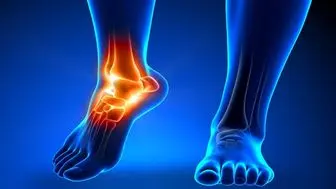درد‌های مچ پا چه زمانی خطرناک هستند؟
