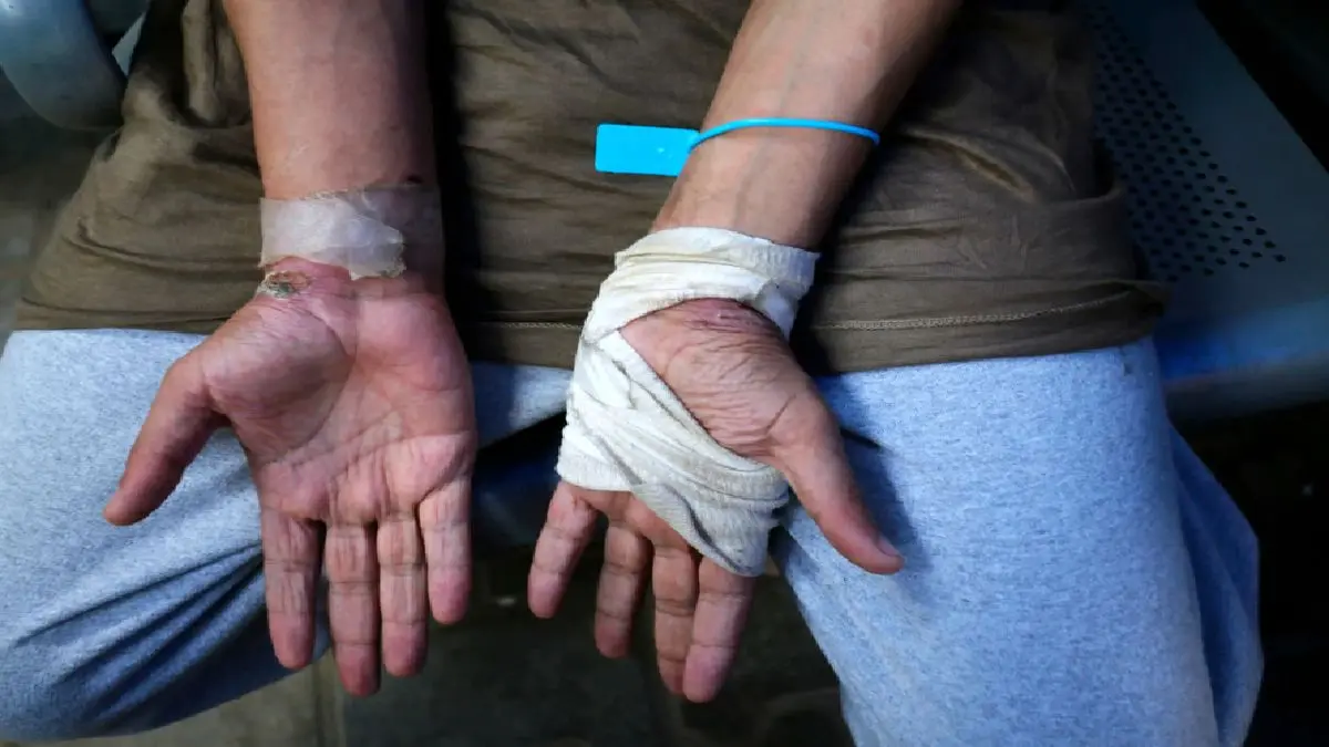 شکنجه پزشکان غزه در سیاه‌چال‌های صهیونیستی