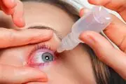 قرمزی چشم را چگونه درمان کنیم؟