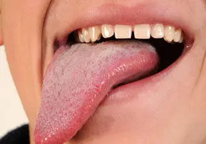 رازهای درباره سلامتی که روی زبان شما نفهفته است