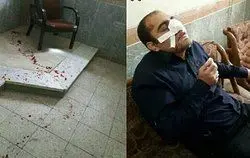 دستور وزیر آموزش و پرورش در پی ضرب و شتم یک معلم