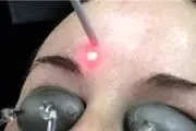 تکنیک های طلایی برای روشن شدن پوست