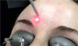 تکنیک های طلایی برای روشن شدن پوست