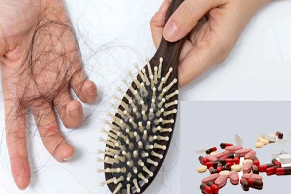 داروهایی که ریزش مو می آورند