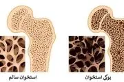 برای جلوگیری از پوکی استخوان چه چیزهایی بخوریم؟