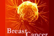 باورهای اشتباه در مورد سرطان پستان