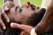 جمجمه بازیکن عربستان خرد شد+ عکس
