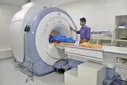 عوارض سی تی اسکن غیرضروری برای سلامت بدن
